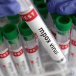 جدري القرود - أمريكا - جدري القردة - جدري