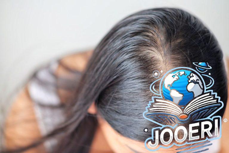 علاج فراغات الشعر الأمامية للنساء
