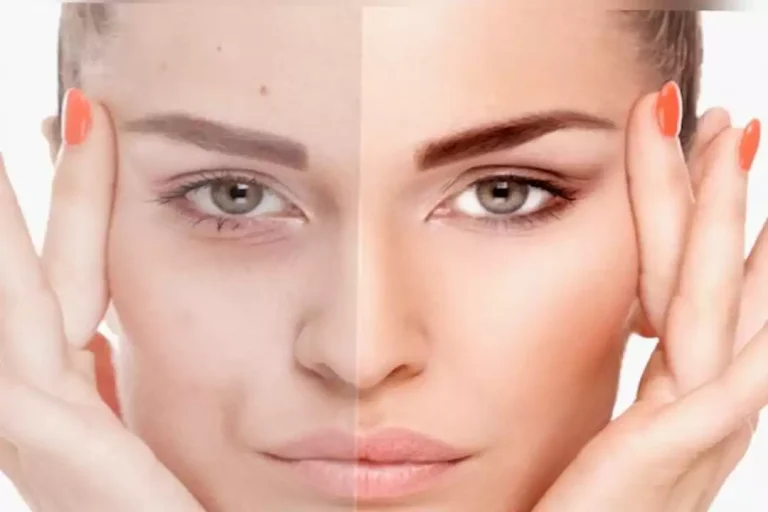 5 طرق فعّالة لإزالة السموم من البشرة