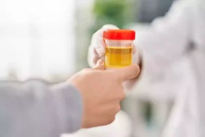 اختبار تحليل البول.. ثورة في الكشف المبكر عن السرطان