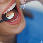 الخطر الخفي - تلف الأسنان الناجم عن اضطرابات الأكل