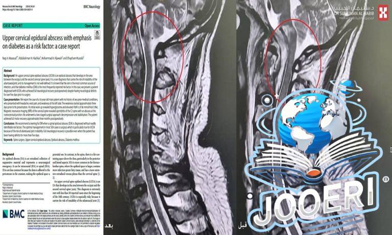 مستشفى الدكتور سليمان الحبيب بالقصيم يُجري عملية نوعية عن طريق الفم لإنهاء معاناة خمسيني مع الشلل