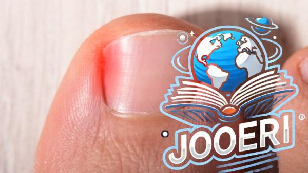 ألم الظفر المغروس في اللحم.. ما الحل؟