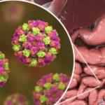 إنفلونزا المعدة الأسباب والأعراض .. معلومات صادمة لا تعرفها عن المرض