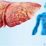 حققنا الهدف الإقليمي لمكافحة التهاب الكبد B