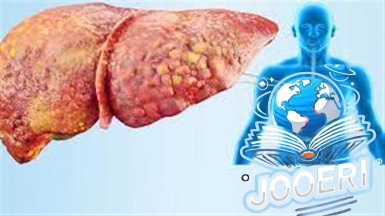 حققنا الهدف الإقليمي لمكافحة التهاب الكبد B