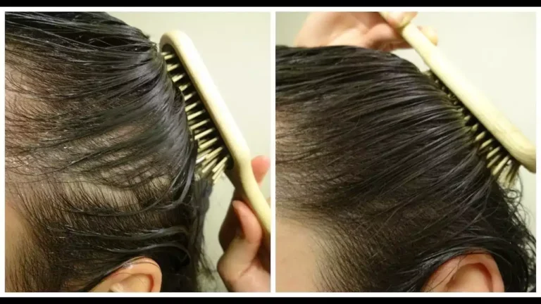 أفضل العلاجات الفعالة لمشكلة تساقط الشعر: ودّع الفراغات واستعد ثقتك بنفسك
